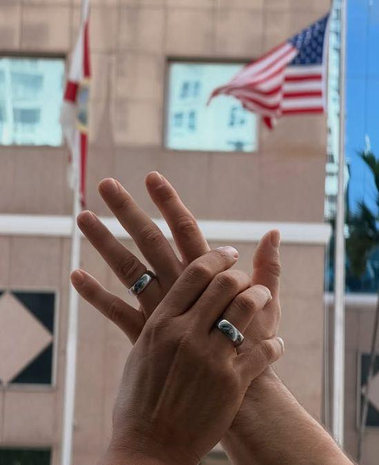 Най-пазената тайна: азис каза „да“ на тайнствен хирург (снимки)